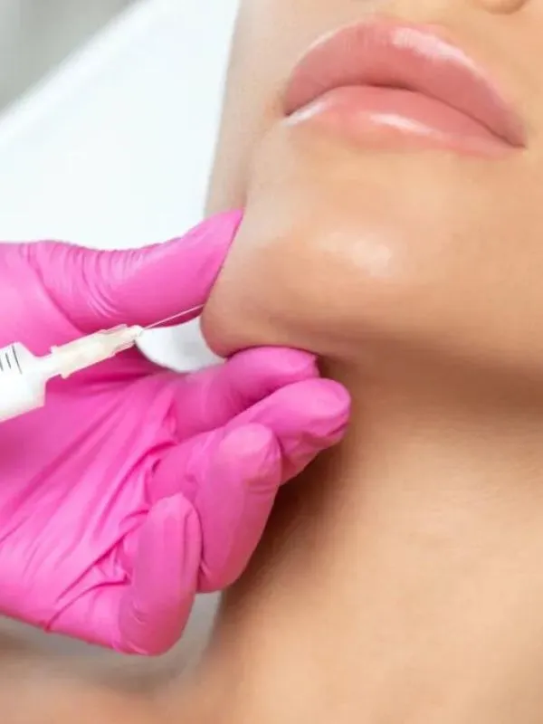 Kybella Injection